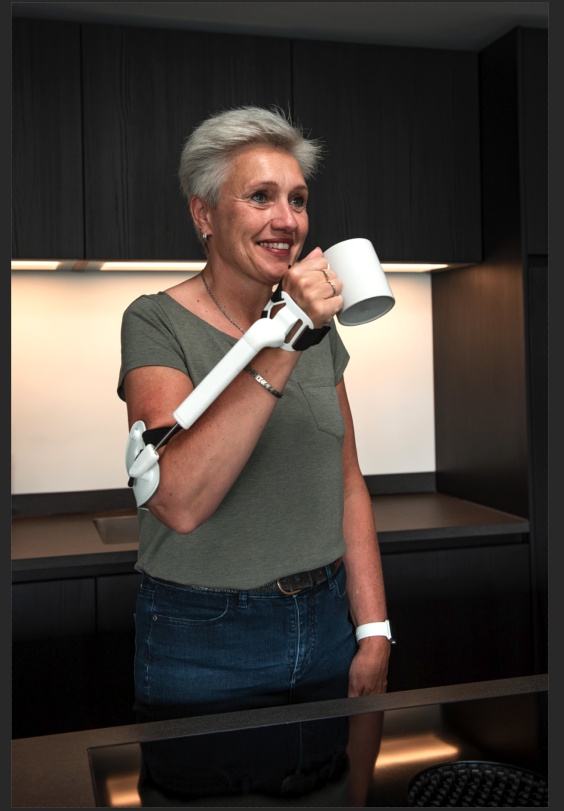 STIL B.V. is endorsed by the Dutch Brain Foundation for the development of the anti-tremor orthosis, a collaboration which enables the company to execute clinical testing